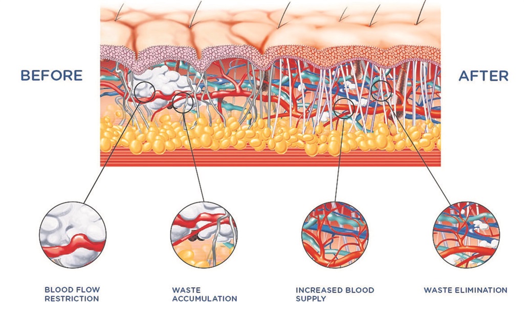 effects of shockwave effects of shockwave