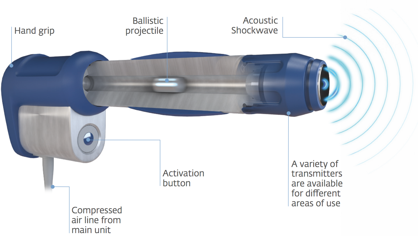 shockwave_therapy_works shockwave_therapy_works